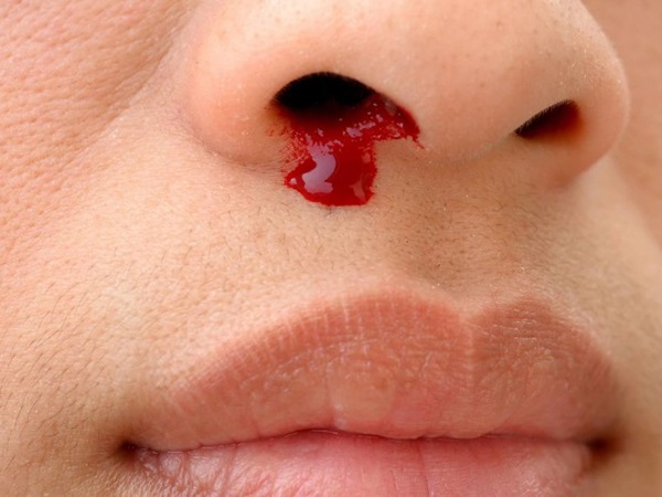 Rùng mình hé lộ điềm báo khi ngủ mơ thấy chảy máu